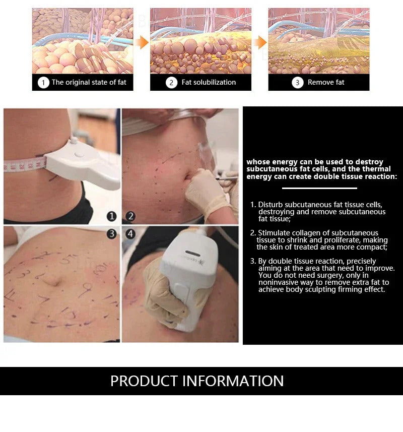 Hot Liposonic Body Slimming Machine Cellulite Massager Liposonix Fat Removal Weight Loss Body Shaping Beauty Equipment