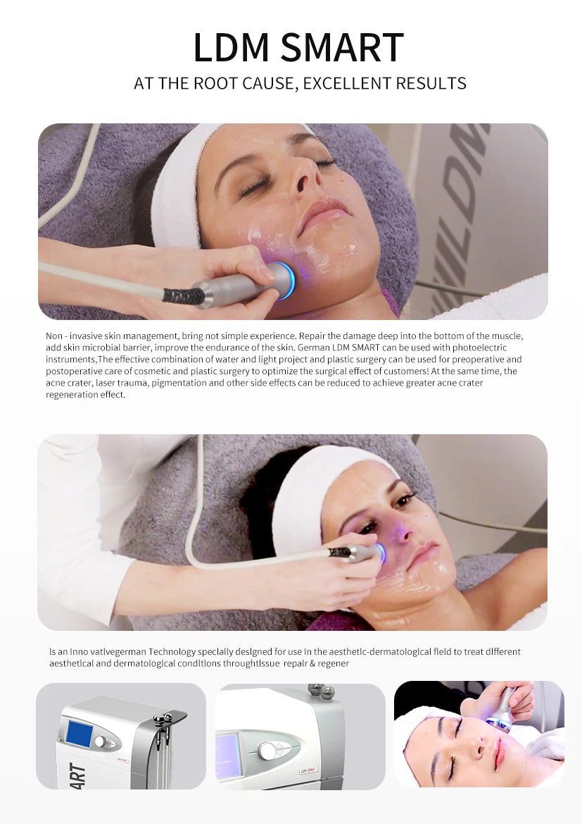 LDM Machine skin rejuvenation machine Local Dynamic Micromassage Ultrasonic beauty machine for Facial anti-aging