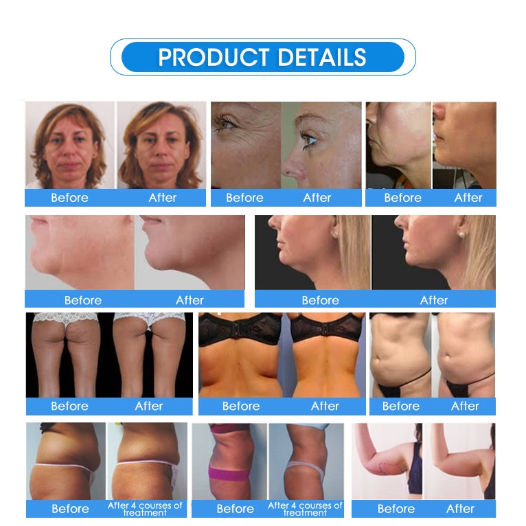 Best Selling Product Vacuum Cavitation System(Except Cryolipolysis Slimming Machine) Weight Loss Fat Burner Machine