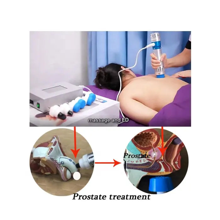 [Fast ship] New ESWT Extracorporeal ShockWave Therapy Machine Therapy Pain Relif Erectile Dysfunction Machine Massager Shockwave Pain Physiotherapy