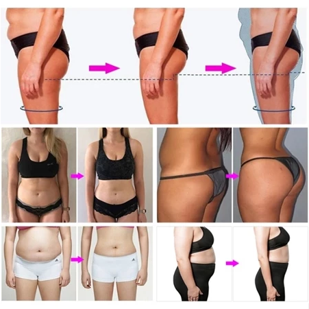 ems massager fat burner machine portable rf slimming machine ems abs stimulator abs trainer