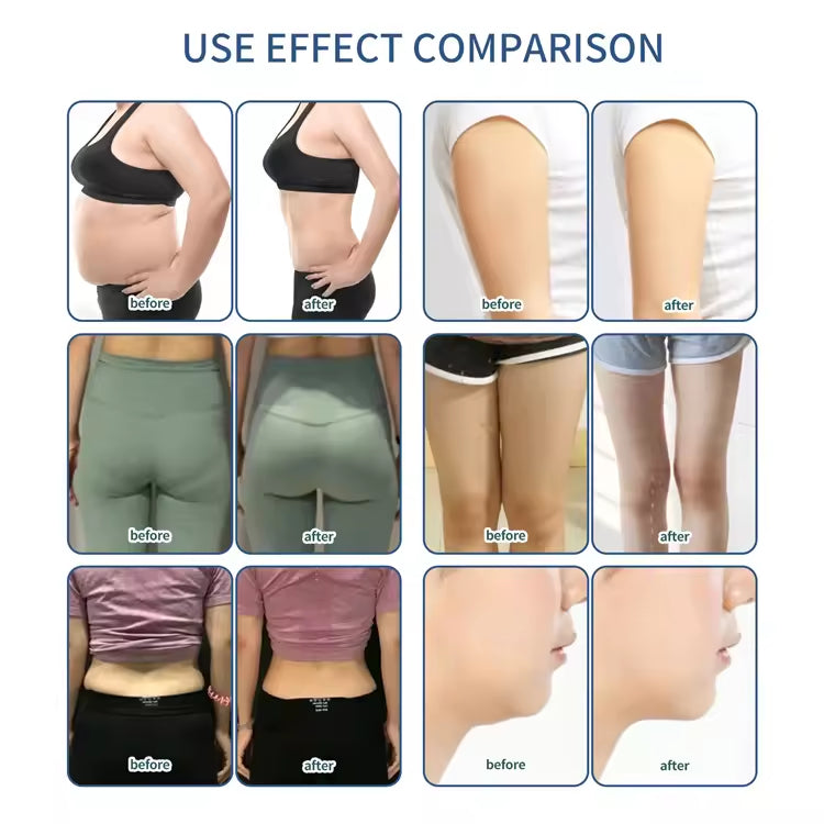 4D Sculpt 360 Cryolipolysis Fat Freezing Cool Ems Slimming Body Sculpt Machine