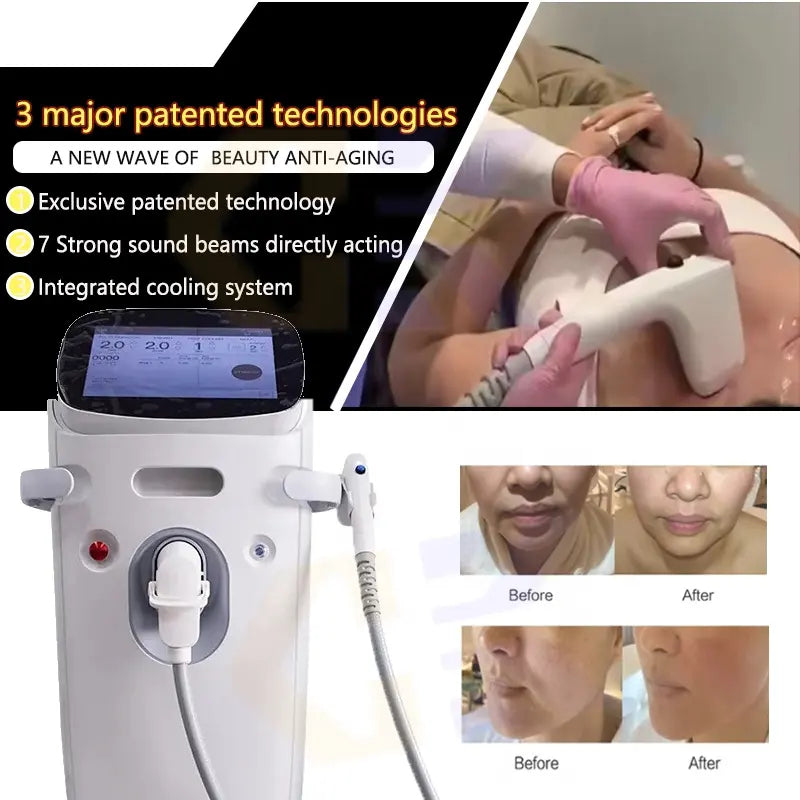 Professional Focused High-intensity Rf Sofwave Beauty Machine Facial Lifting Anti Wrinkled Body Face Removal Skin Care Products