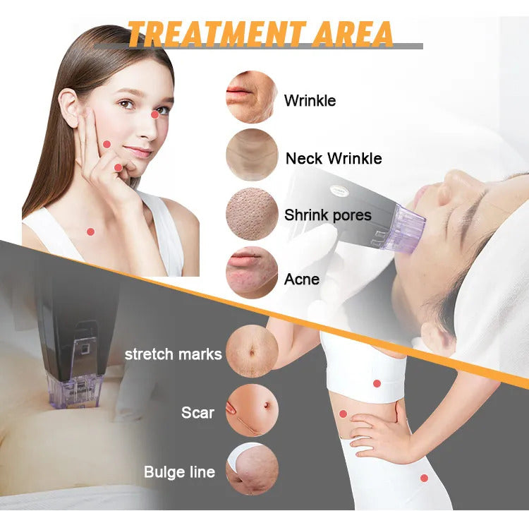 fractional gold rf beauty machine like morephus 8 style acne removal + 4 tip