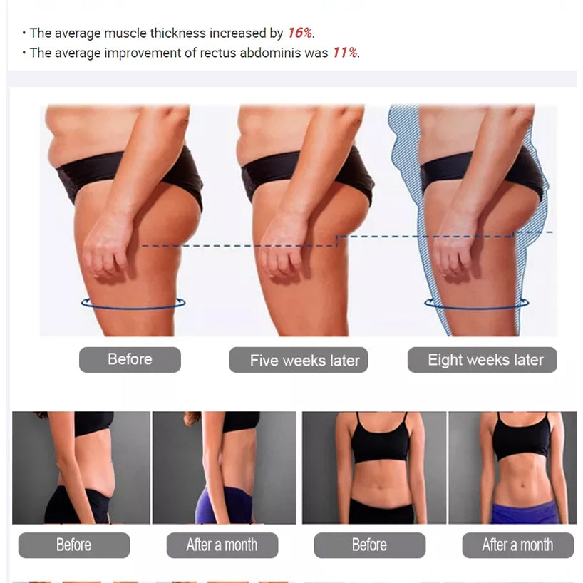 New Arrivals 5 Handle Rf Body Sculpting Machine Muscle Building Neo RF Muscle Building Body Slimming Body Sculpting Machine