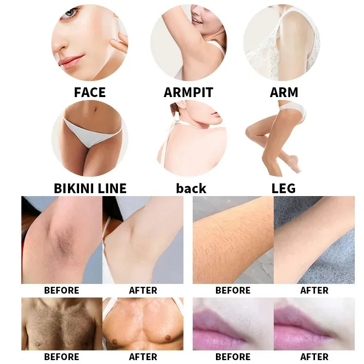 808 Diode Laser Beauty Machine Skin Rejuvenation Laser Hair Removal for Face and Body Permanent Epilation Laser