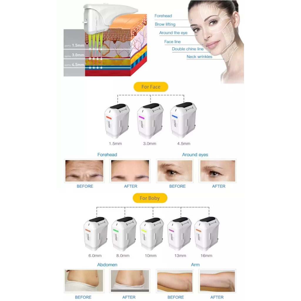 Portable 9D HIFU Facial Lifting Anti Aging Wrinkle Removal V-aginal tightening repair  Beauty Machine with rf thermage Face Sculptor Skin Tightening Anti-wrinkle Device