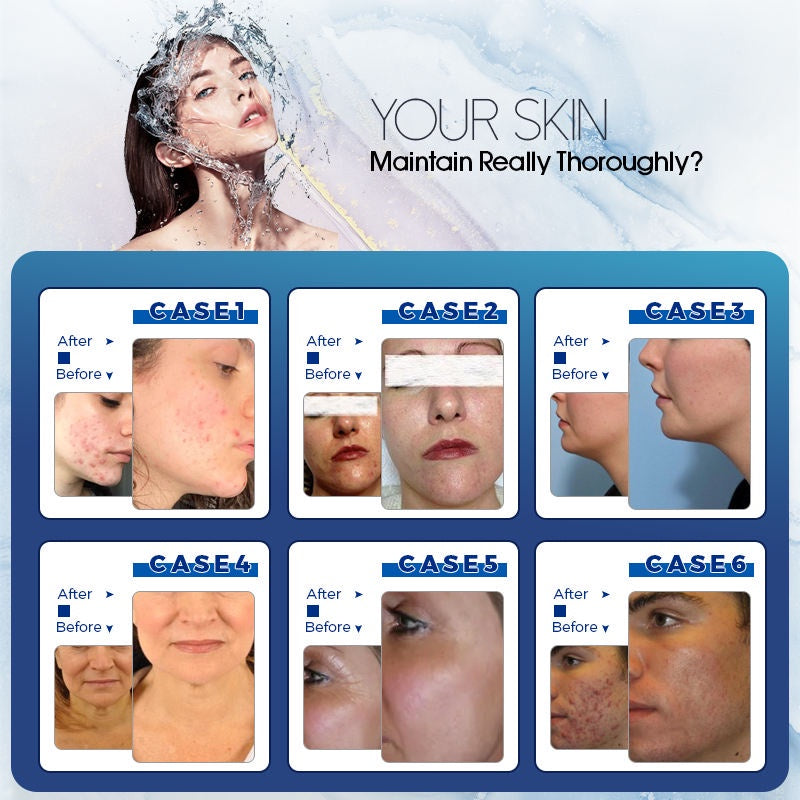 Multifunction 7 In 1 Oxygen Diamond dermabrasion H2O2 Aqua Peel Facial Hydra Machine / Microdermabrasion Machine