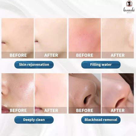 Hot sales Top quality 6 in 1 Hydra Oxygen Jet Dermabrasion Hydro Aqua Peeling Beauty Face Equipment Salon Facial Machine