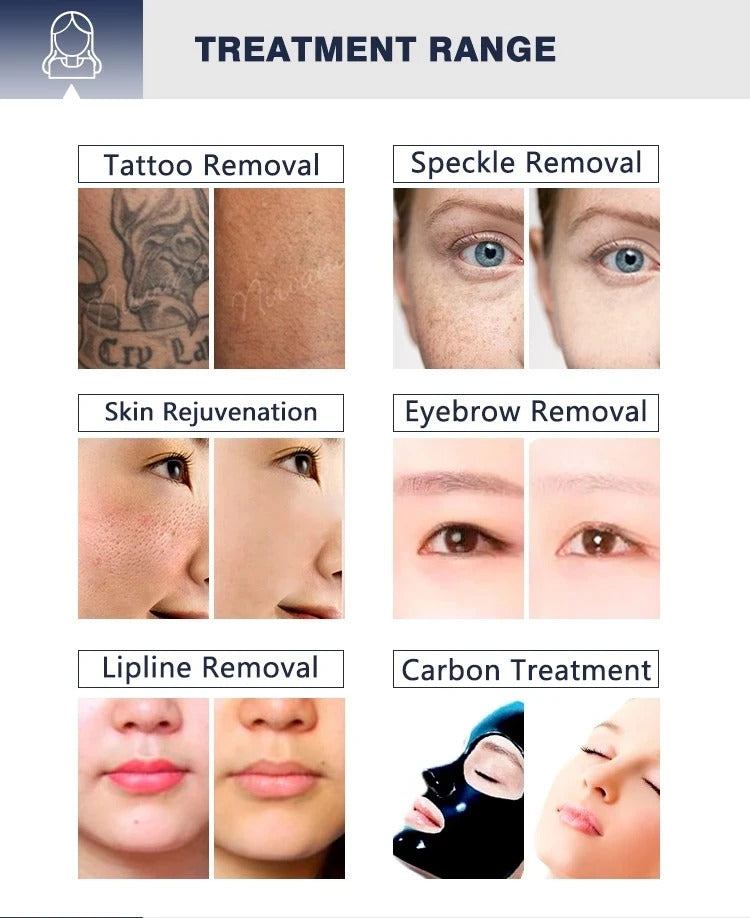 Portable Picosecond Lazer Tattoo Rem Carbon Peeling Skin Whitening Non Invasive Skin Rejuvenation Laser Machine