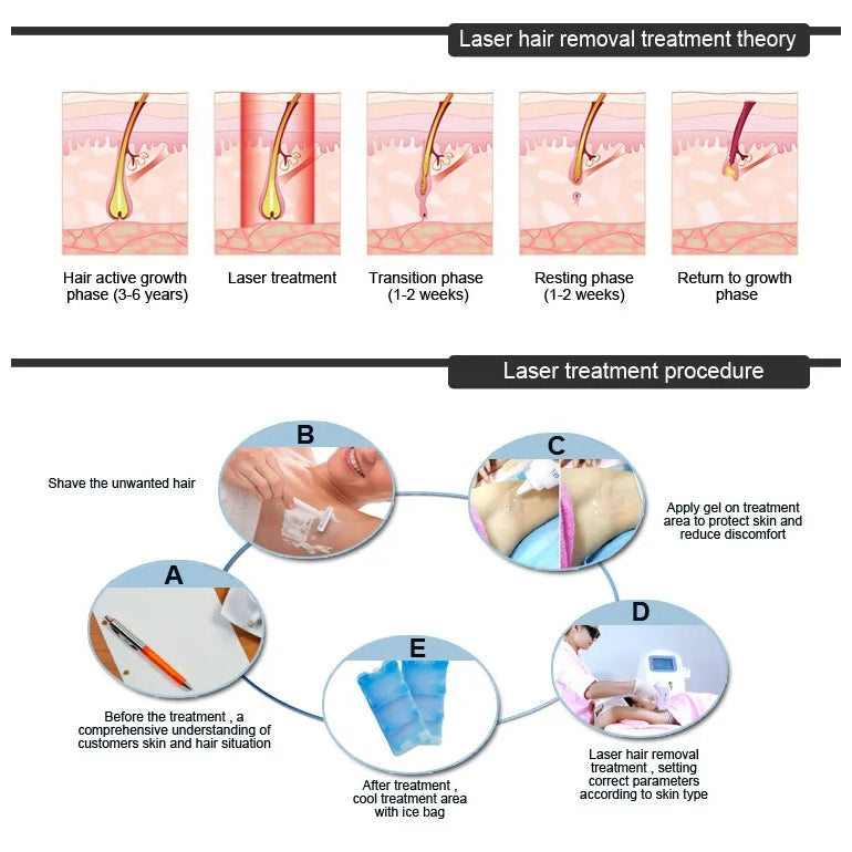 808 Diode Laser Beauty Machine Skin Rejuvenation Laser Hair Removal for Face and Body Permanent Epilation Laser