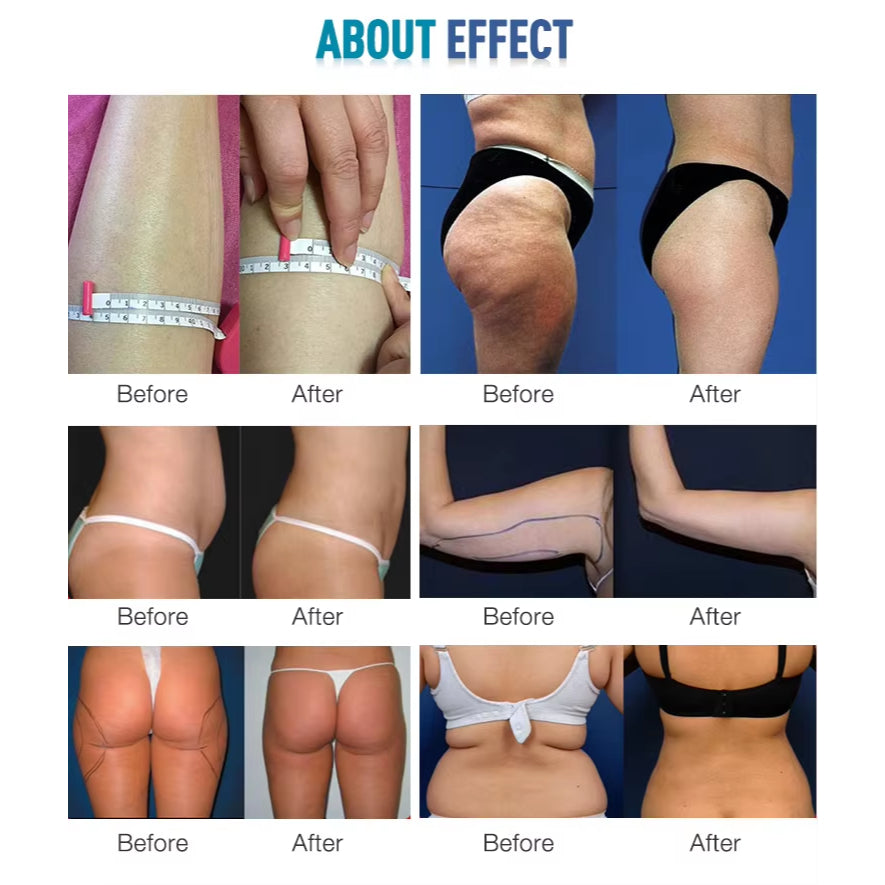 Professional Slimming Machine 40K fat reduce 80K Weight loss cellulite remove Machine