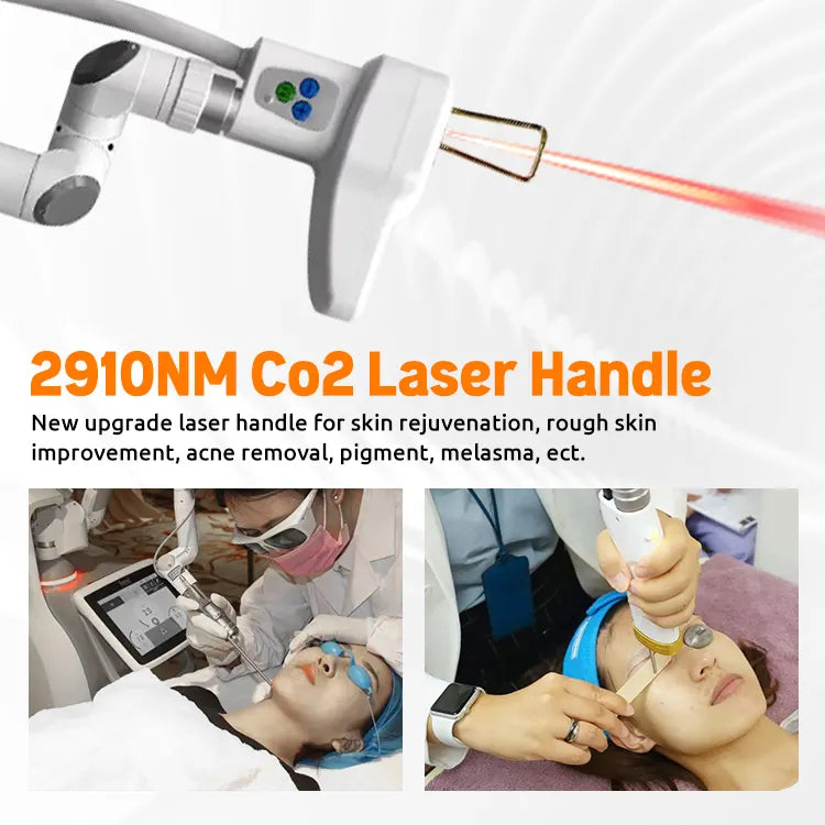 4D Co2 Fractional Laser Machine Fotona 4d Erbium Yag Laser 2940 Fotona Laser Fraccionado Co2 Dermatology Equipment