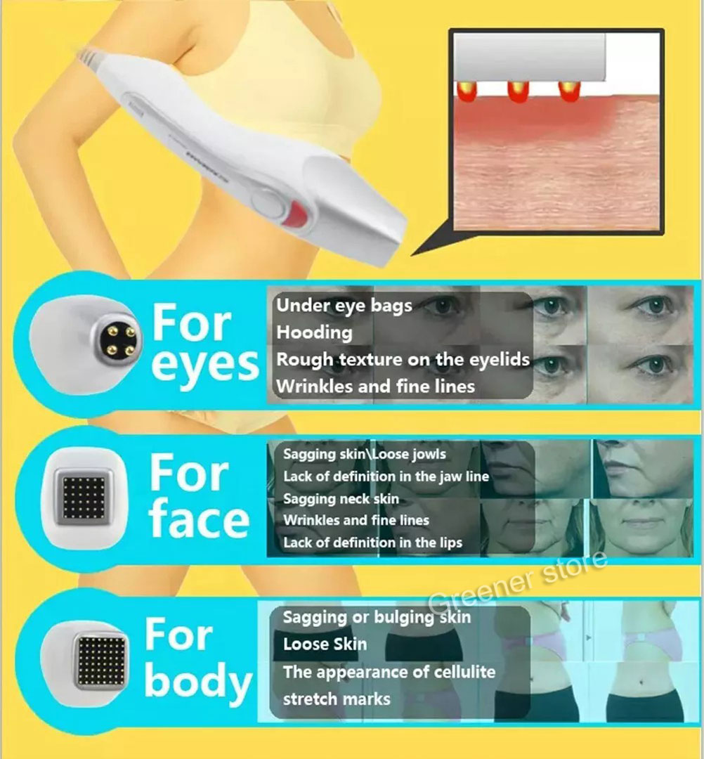 Beauty Machine Skin Tightening Eye Lifting Wrinkle Remove RF-Fractional Home Use