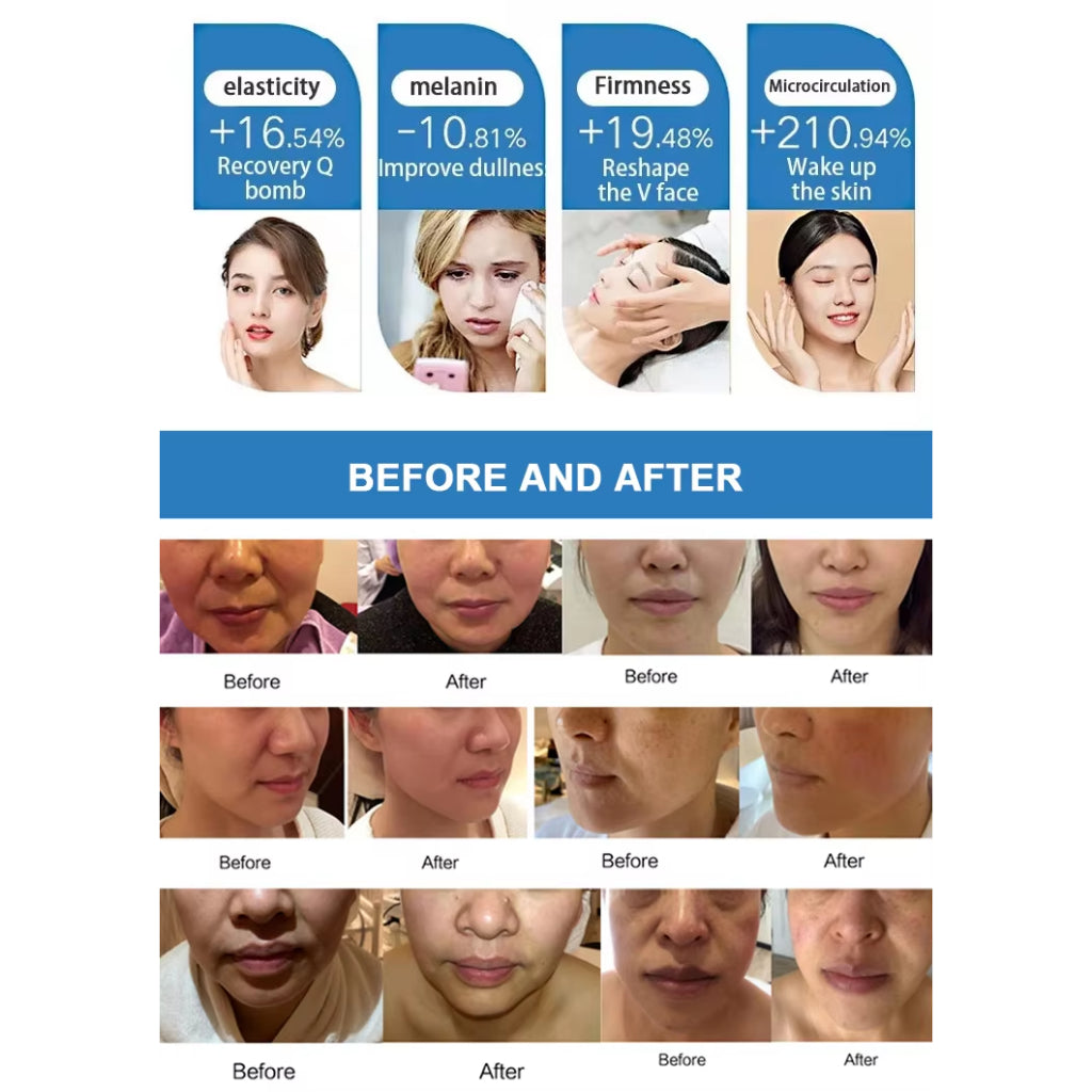 Professional Focused High-intensity Rf Sofwave Beauty Machine Facial Lifting Anti Wrinkled Body Face Removal Skin Care Products