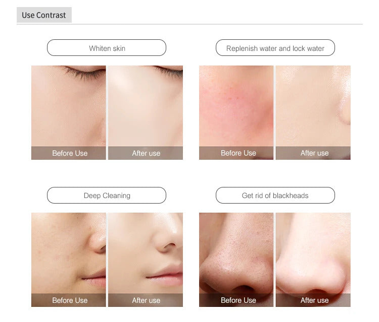 6 in 1 Small Bubble Machine Oxygen Jet Peel Device Deep Skin Cleaning Beauty Equipment BIO Face Lift Skin Cleansing Ati Aging