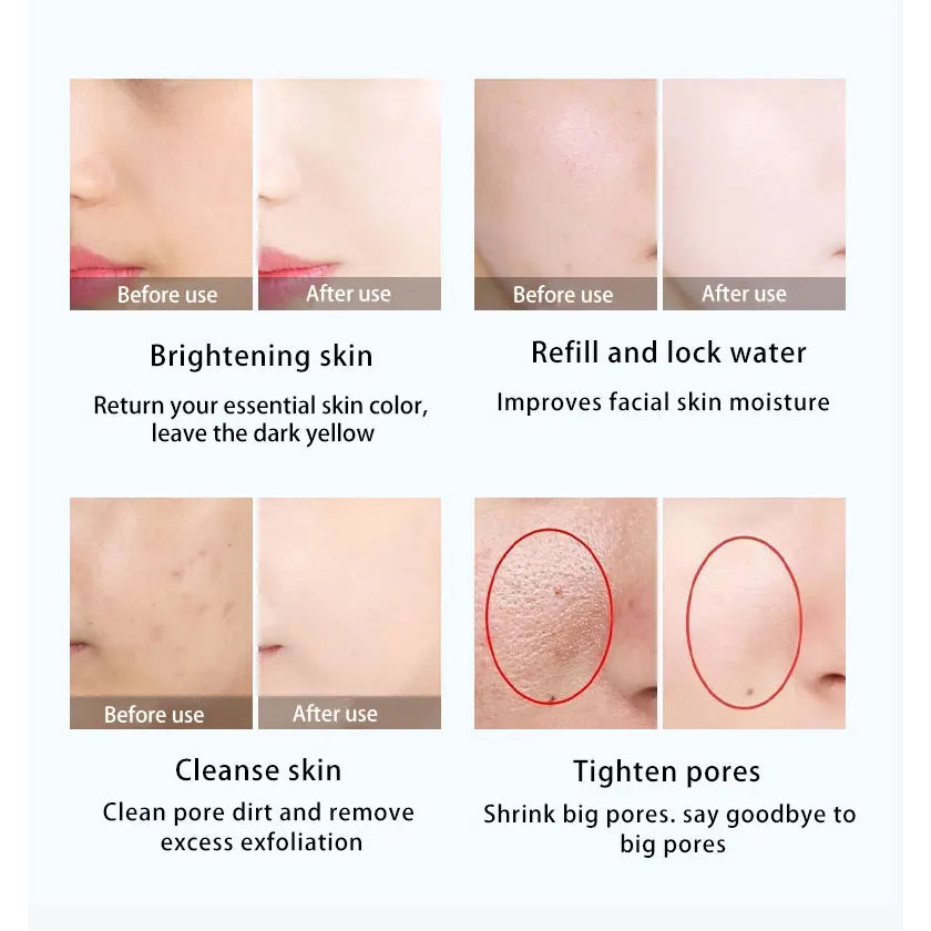 Cryo Facial Electro poration Cooling Heating Skin Lifting Skin Calming Ion Wrinkle Removal Machine