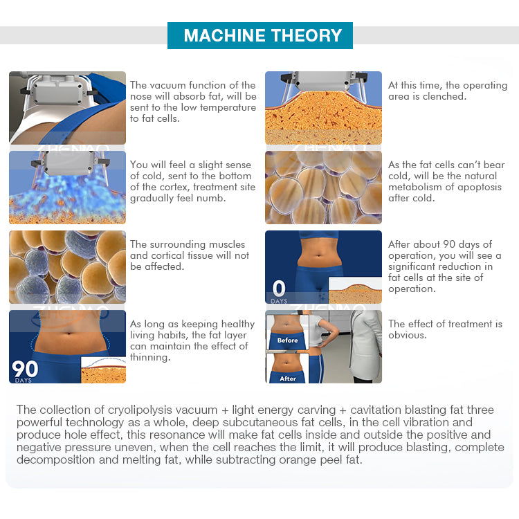 Cryo Electroporation Beauty Machine For Tightening At Removal Slimming Machine Vacuum Weight Loss Machine At Removal Slimming