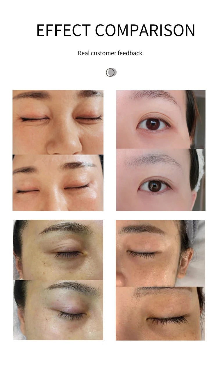 Face Lifting Lighten Fine Lines And Dark Circles Under The Eyes BIO Microcurrent Roller Massage Beauty Equipment Anti Aging