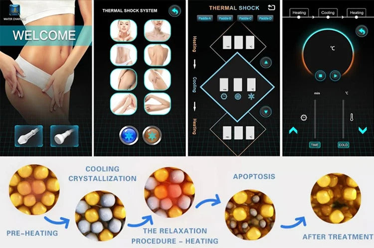 2025 Portable Cryo T-Shock Slimming Machine Professional Skin Cooling Device for Face And Body - Advanced Technology for Beauty