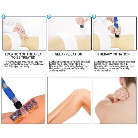 Hot sales physical therapy Extracorporeal Shock Wave Therapy Equipment Medical ed shock wave device physical therapy