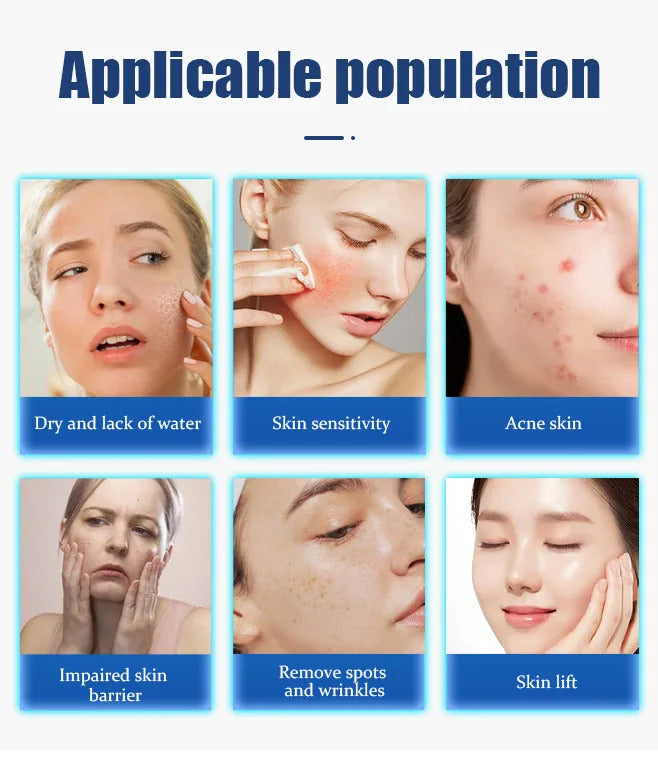 LDM Face Lifting Micromass anti-aging Rejuvenation wrinkle Removal Firming Weight Loss Salon Anti-aging Collagen Beauty Machine