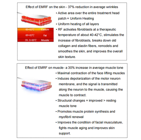 Firming face Muscle Shaping Sculpting Radio Frequency Skin Tightening Face Lift EMS beauty machine