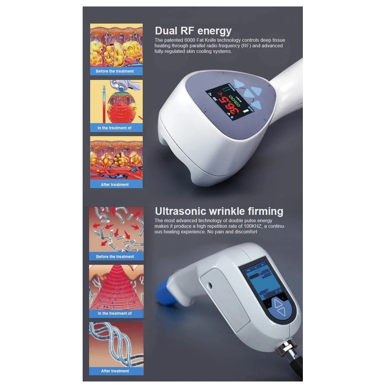 Hot sale exili rf Focused RF Ultrasound Machine For Body Slimming exilis RF Wrinkle Removal Face Lifting machine