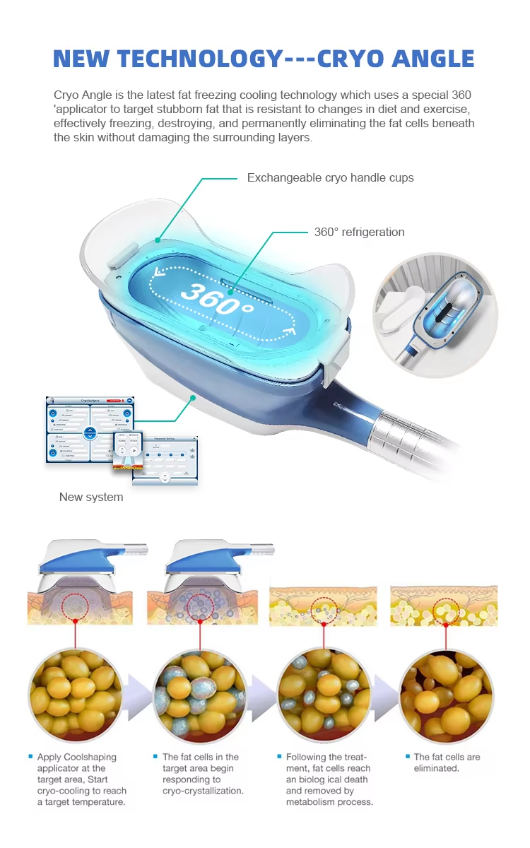 Cryo Therapy Criolipolysis Fat Freezing Cryolipolysis 360 Degree Cryolipolysis Body Slimming Machine