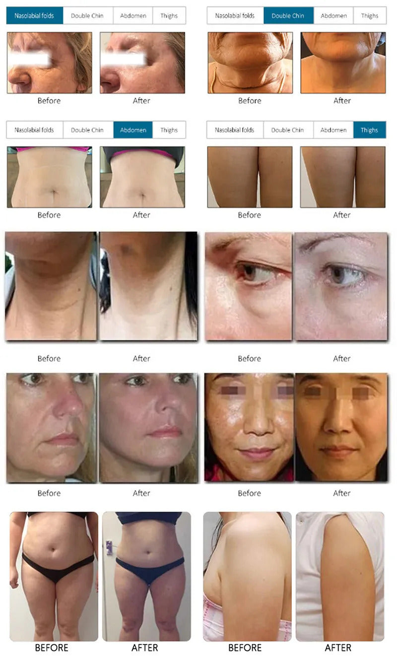 7D beauty machine facial neck lifting wrinkle removal
