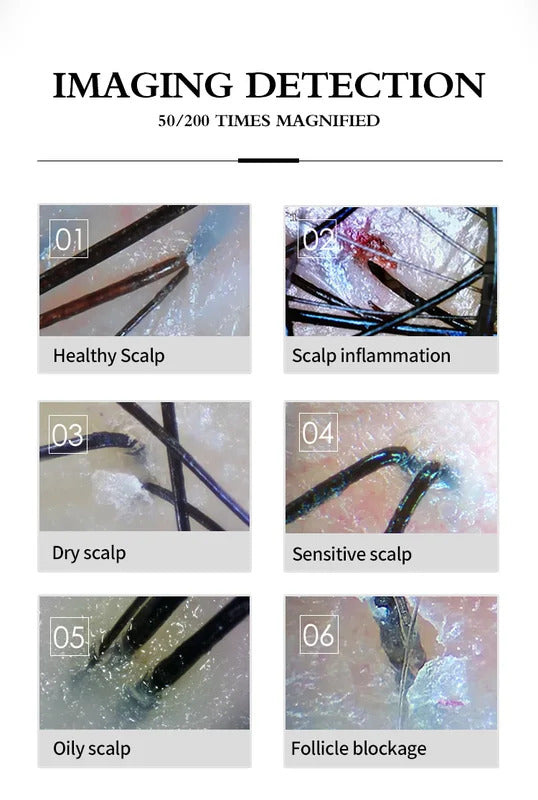 HD 50/200X Hair Scalp Skin Analyzer with Freeze Frame Oil Moisture Test Portable Digital Microscope for Follicle Detection