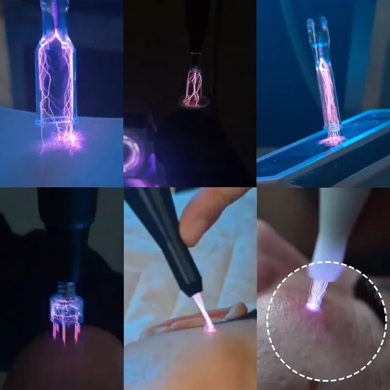 Cold Fusional Plasma Machine for Scar Removal and Skin Rejuvenation Anti-aging Collagen Regeneration Plasma Fusional Machine