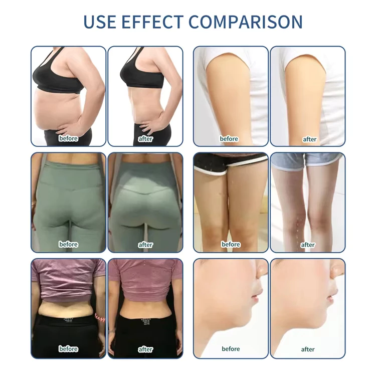 5 in 1 Beauty Equipment Roller Massage Roller Heads Cavitation Vacuum Radio Frequency Body Massage Rf Slimming Machine For Salon
