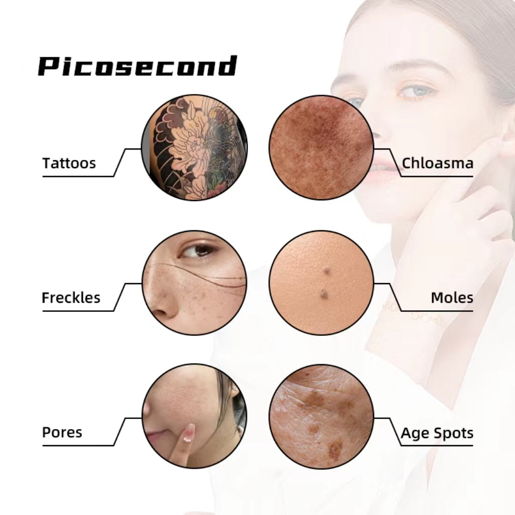 Laser Tattoo Removal  Picosecond Equipment  New Upgraded Freckle Machine Q-switched Advanced Skin Pigment Removal Machine