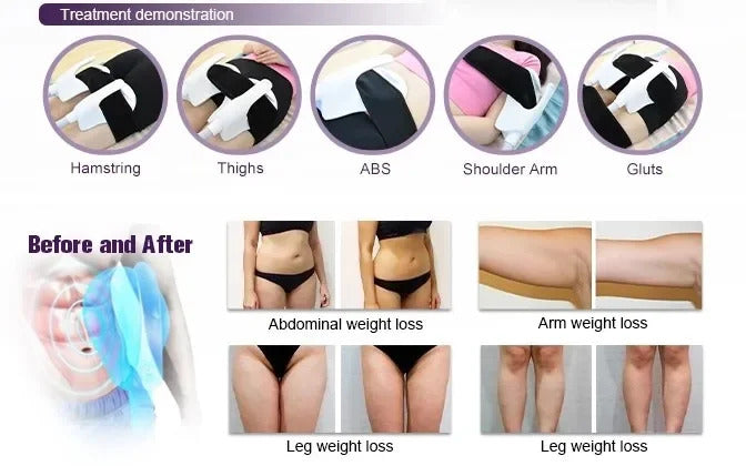 New Arrival EMS Sculpting Body Contouring Body Slimming Machine Fat Burning Weight Loss Muscle Building Skin Firming Device