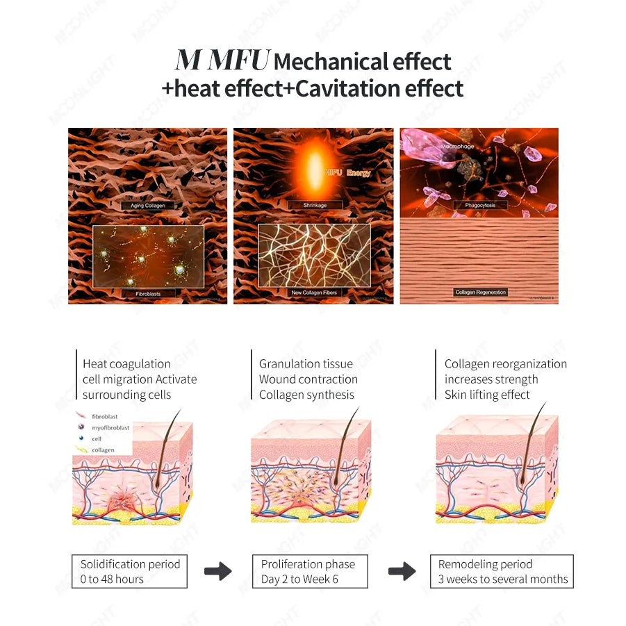 2 IN1 7d Hifu Machine Skin Tightening Rf Microneedling Smas Lifting  Portable 7d hifu smas Anti-wrinkle  face lifting Hifu Machine