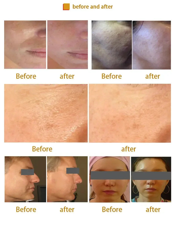 LDM Machine skin rejuvenation machine Local Dynamic Micromassage Ultrasonic beauty machine for Facial anti-aging