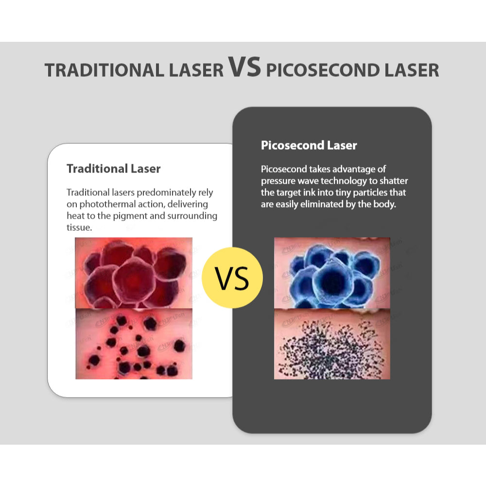 Super Picosecond laser 532nm 785nm 1064nmr machine for Tattoo Removal Freckle RemovalQ Switch Nd Yag Laser