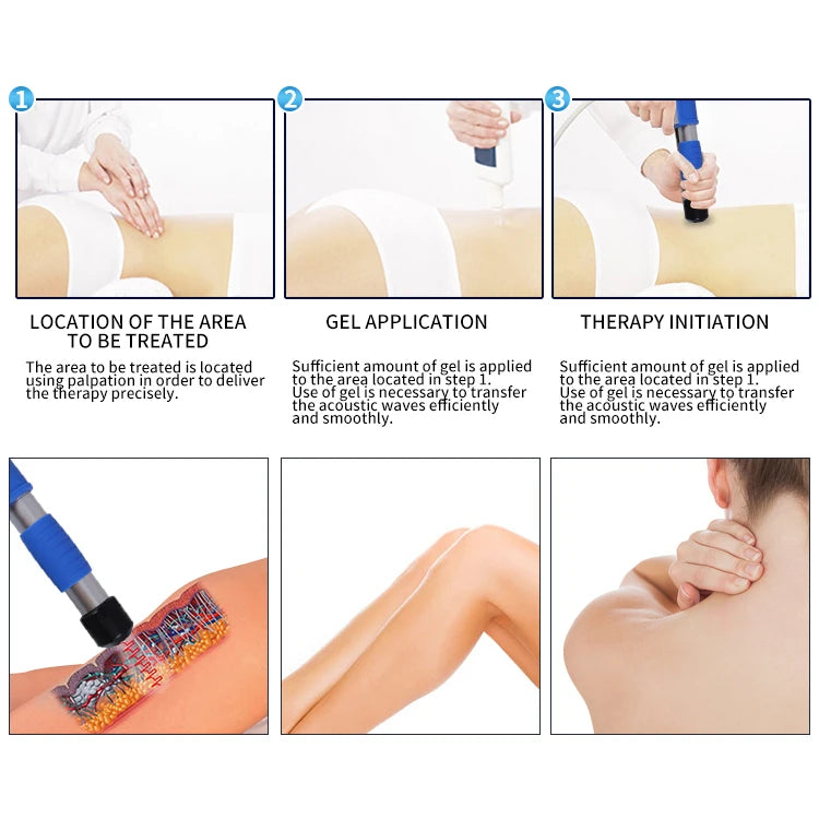 Shockwave Therapy Device ED Shockwave Erectile Dysfunction Focused 10Bar Shockwave Machine