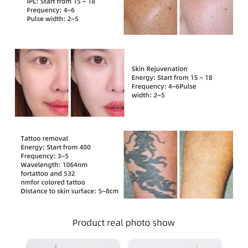 808nm Diode pico laser machine for hair removal and tattoo removal 808 pico 2 in 1