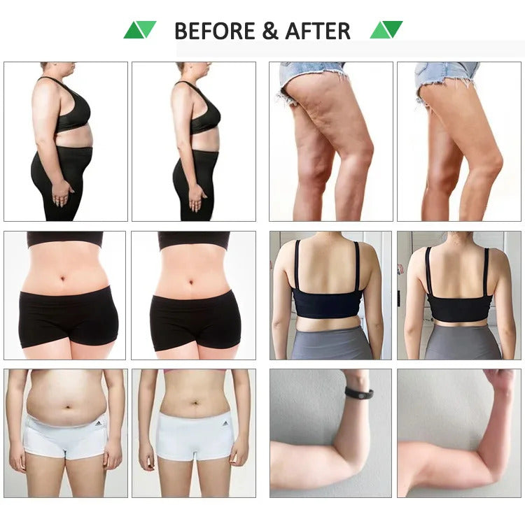 Hot salon Green Red light 10D lipo Laser slimming machine 532nm laser weight loss body sculpting lipo cavitation 2025