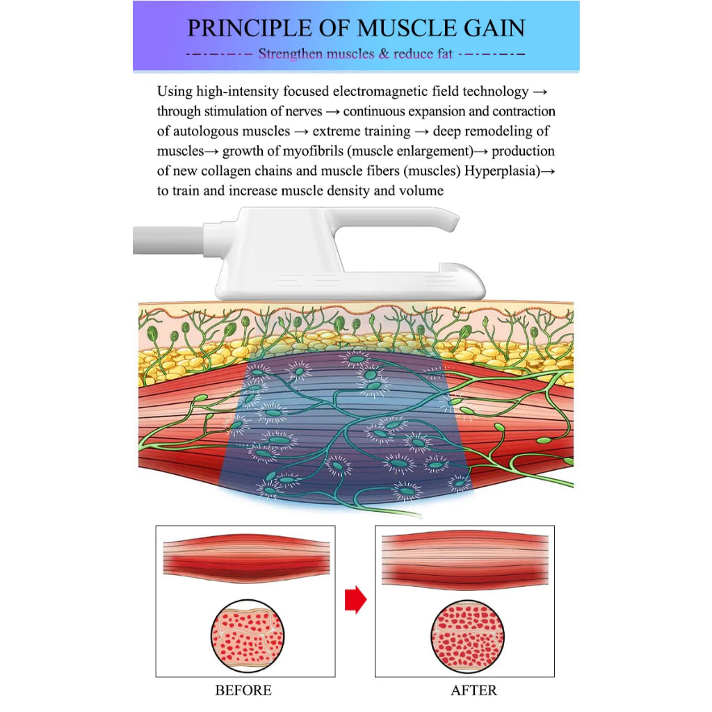 New Technology Medical Weight Loss Fat Removal Ems Machine For abdomen body arms