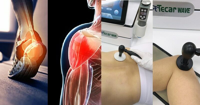 Sport Physical Shockwave Therapy Machine F Low Back Pain Tecar Massage Equipment