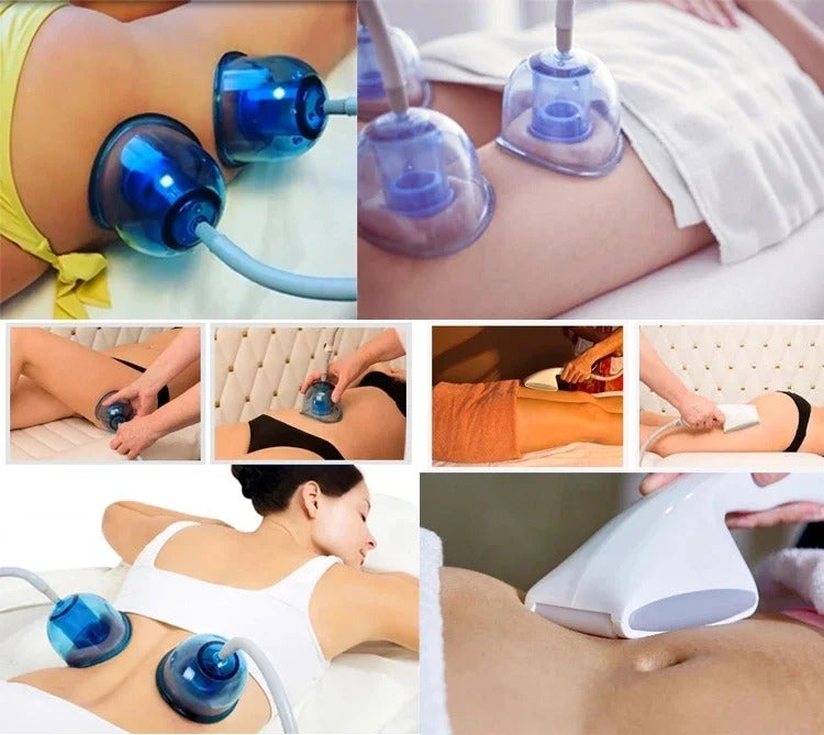 Newest Vacuum Roller Suction Fat Loss Machine SP2 Starvac Breast Enlargement Butt Enlargement Weight Loss Massager Machine