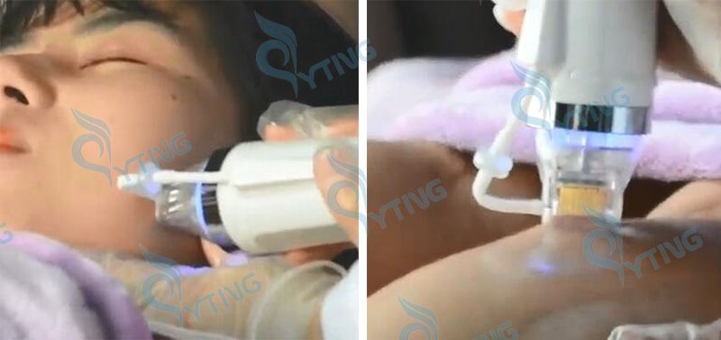2 in 1 gold-RF Beauty Machine Radiofrequency Ice Hammer + 4 cartridge