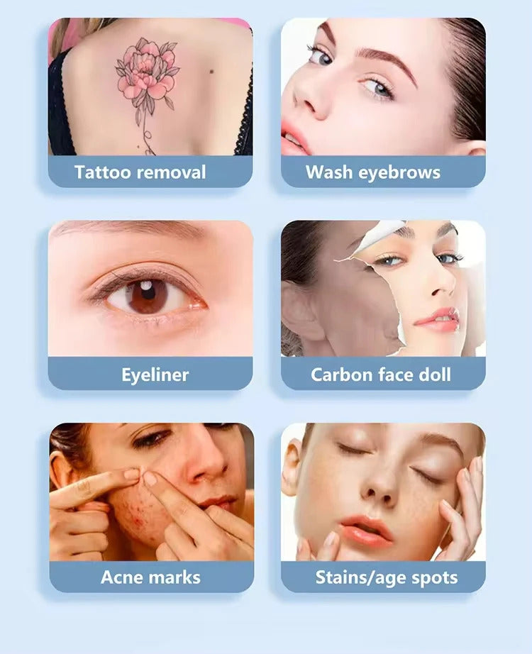 Laser Tattoo Removal  Picosecond Equipment  New Upgraded Freckle Machine Q-switched Advanced Skin Pigment Removal Machine