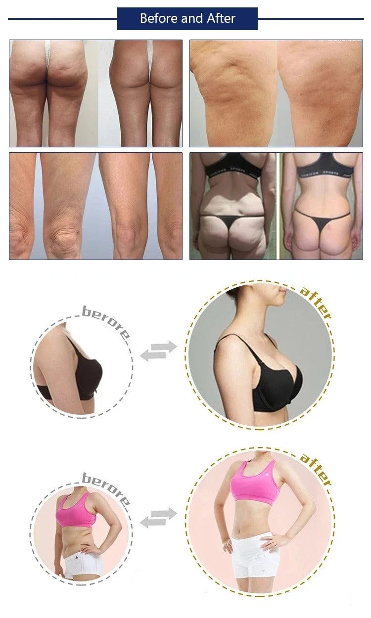 Newest Vacuum Roller Suction Fat Loss Machine SP2 Starvac Breast Enlargement Butt Enlargement Weight Loss Massager Machine