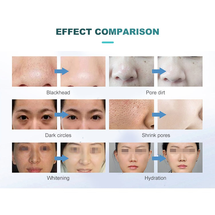Multifunction 7 In 1 Oxygen Diamond dermabrasion H2O2 Aqua Peel Facial Hydra Machine / Microdermabrasion Machine