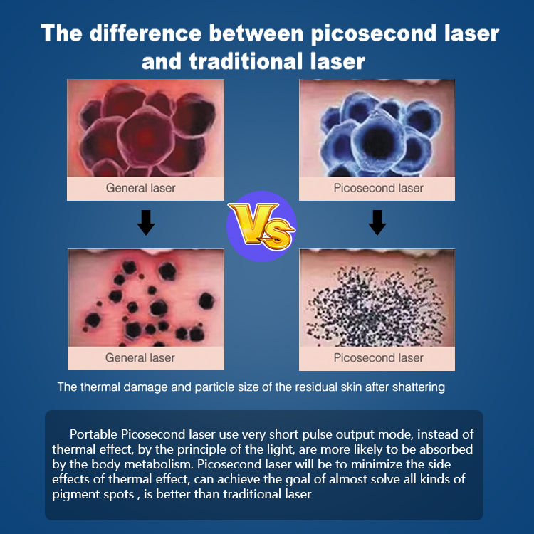Laser Tattoo Removal  Picosecond Equipment  New Upgraded Freckle Machine Q-switched Advanced Skin Pigment Removal Machine