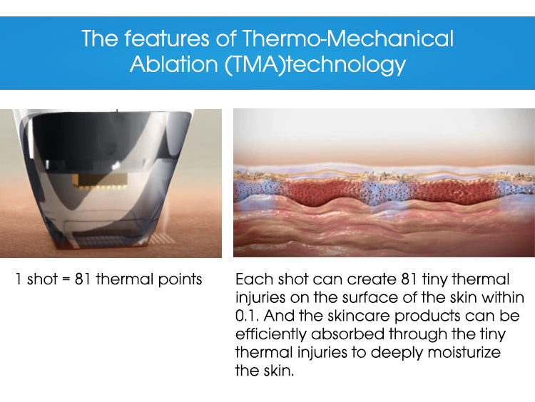 Novoxel Tixel 2 Thermal Fractional Mezotix Machine WithTwo Handle Pigment Scar Wrinkle Stretch Removal Machine-2025 999